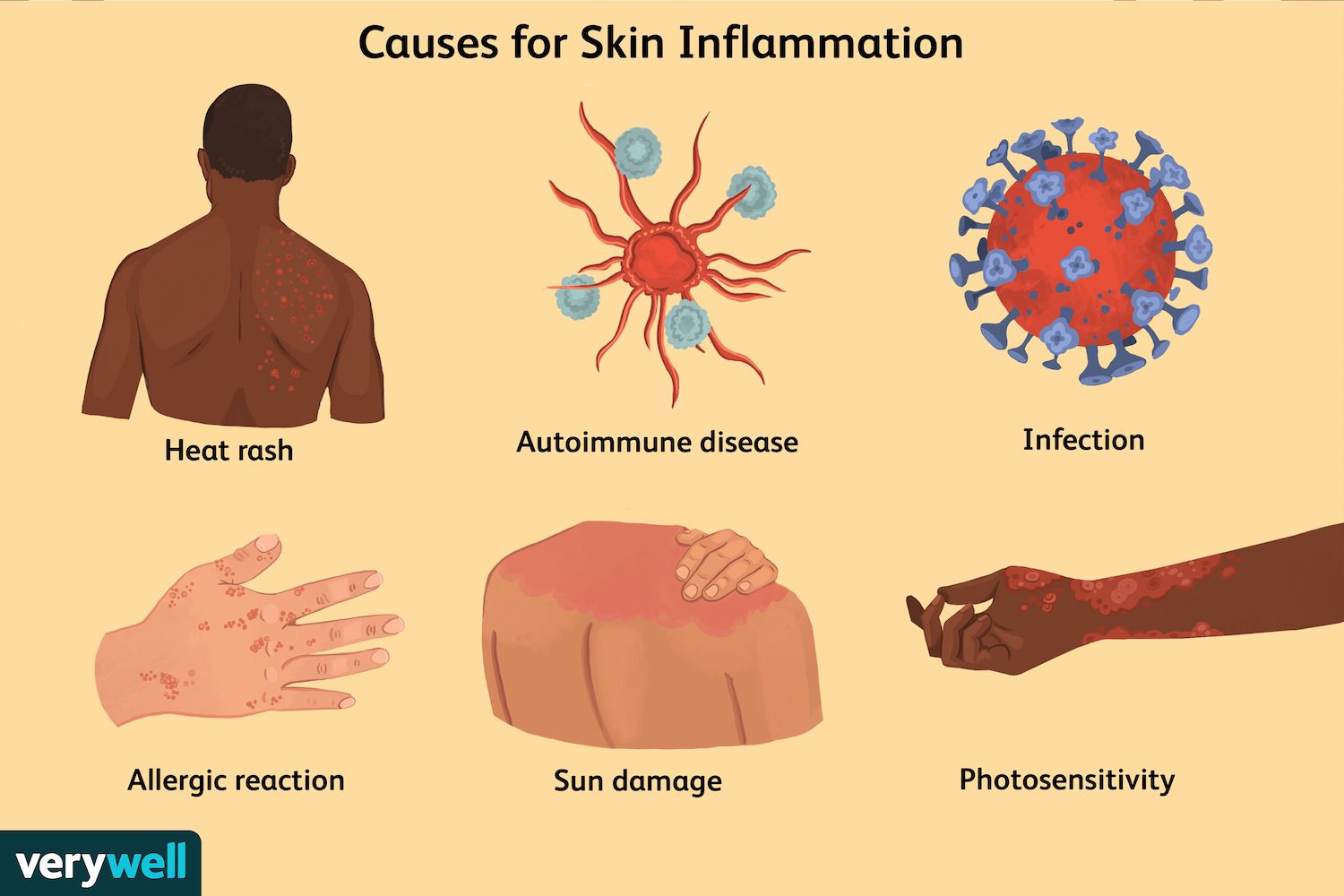 What s The Big Deal About Inflammation And How Awful Is It 